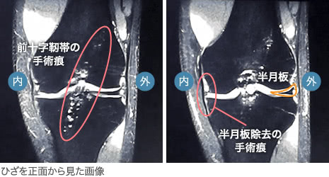 ひざmri即日診断について 東京ひざ関節症クリニック