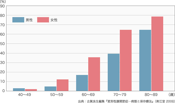 変形性ひざ関節症の年齢別・性別割合