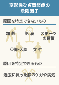 変形性ひざ関節症の危険因子
