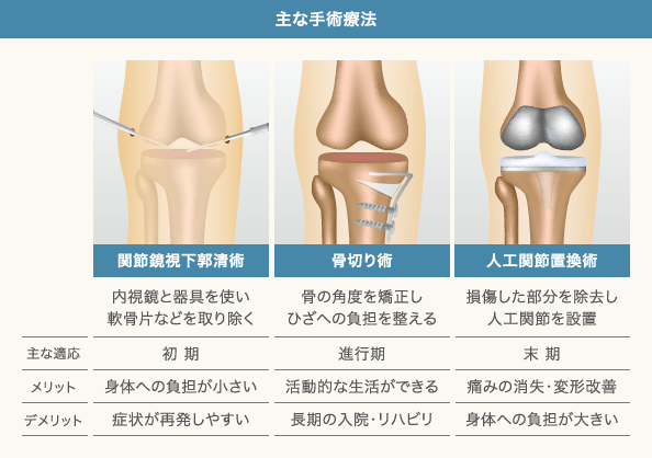 変形性ひざ関節症の手術と適応、メリット、デメリット