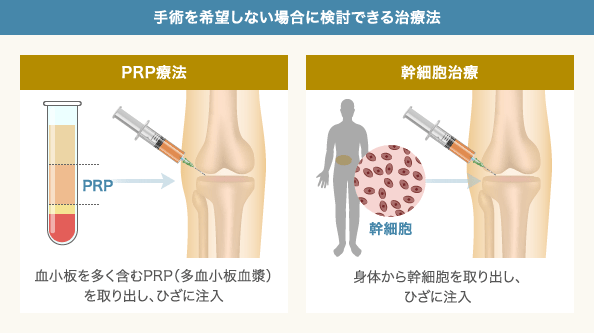 膝 が 鳴る スクワット