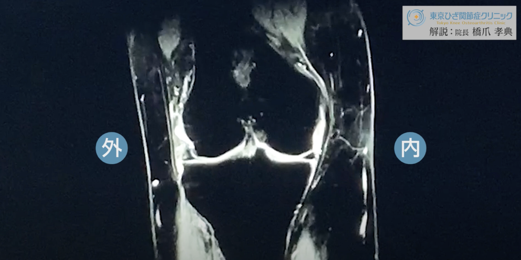 関節のMRI - 健康/医学 関節のMRI - 健康/医学