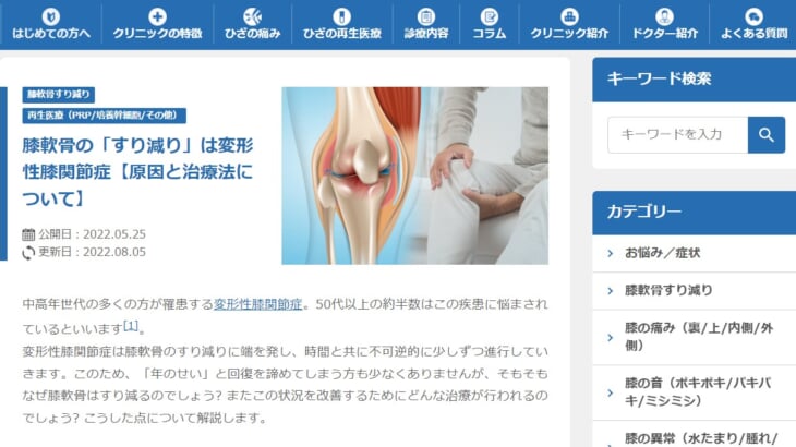 人工関節の手術を迷っている方へ】監修コラムで情報提供 | 東京